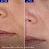 Jenpharm Dermive Sensitive Moisturizer