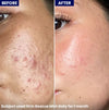 Jenpharm Skin Rescue Mist 100ml