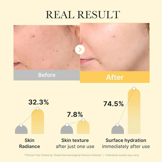 Medicube Kojic Acid Turmeric Brightening Gel Mask