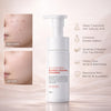 GoodnDoc AC Control Blemish Foaming Cleanser 150ml
